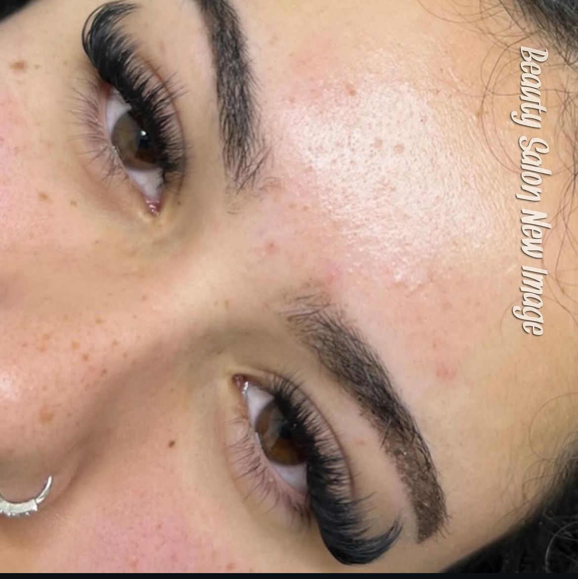 Laminim vetullash dhe extension
